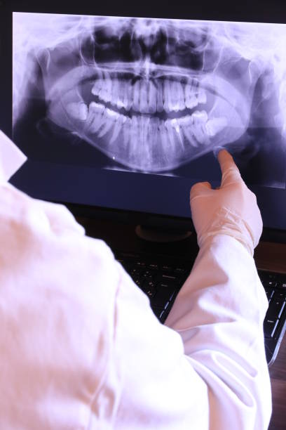 Best Emergency Root Canal Treatment in Paradise, CA