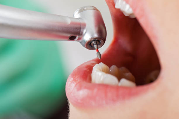 Best After-Hours Emergency Dentist in Paradise, CA